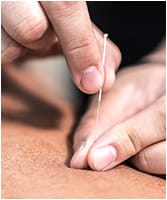 Acupuncture & Cranial Therapy